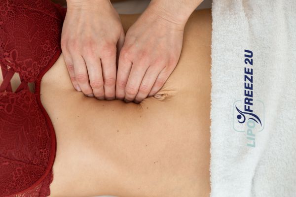 diastasis recti treatment Uppingham