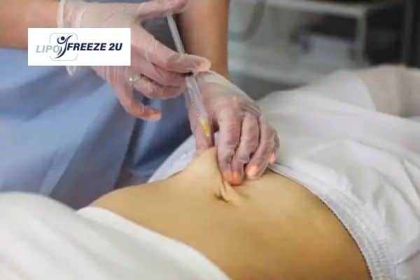 Fat Dissolving Injections Uppingham & Weight loss medication