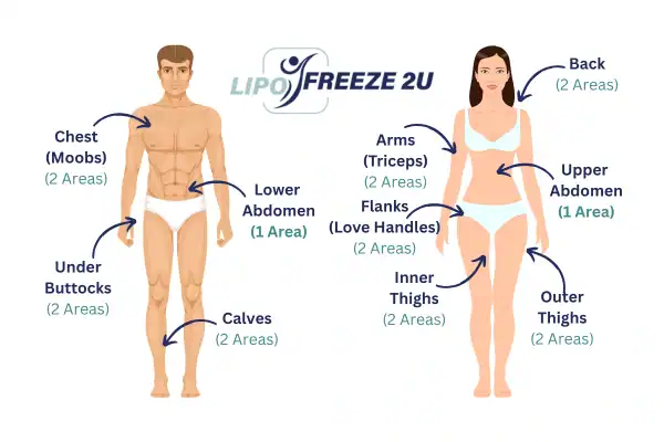 Areas you can have fat freezing treatment Uppingham