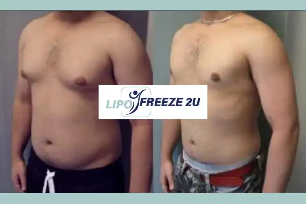 How Long Does It Take to See Results Uppingham?