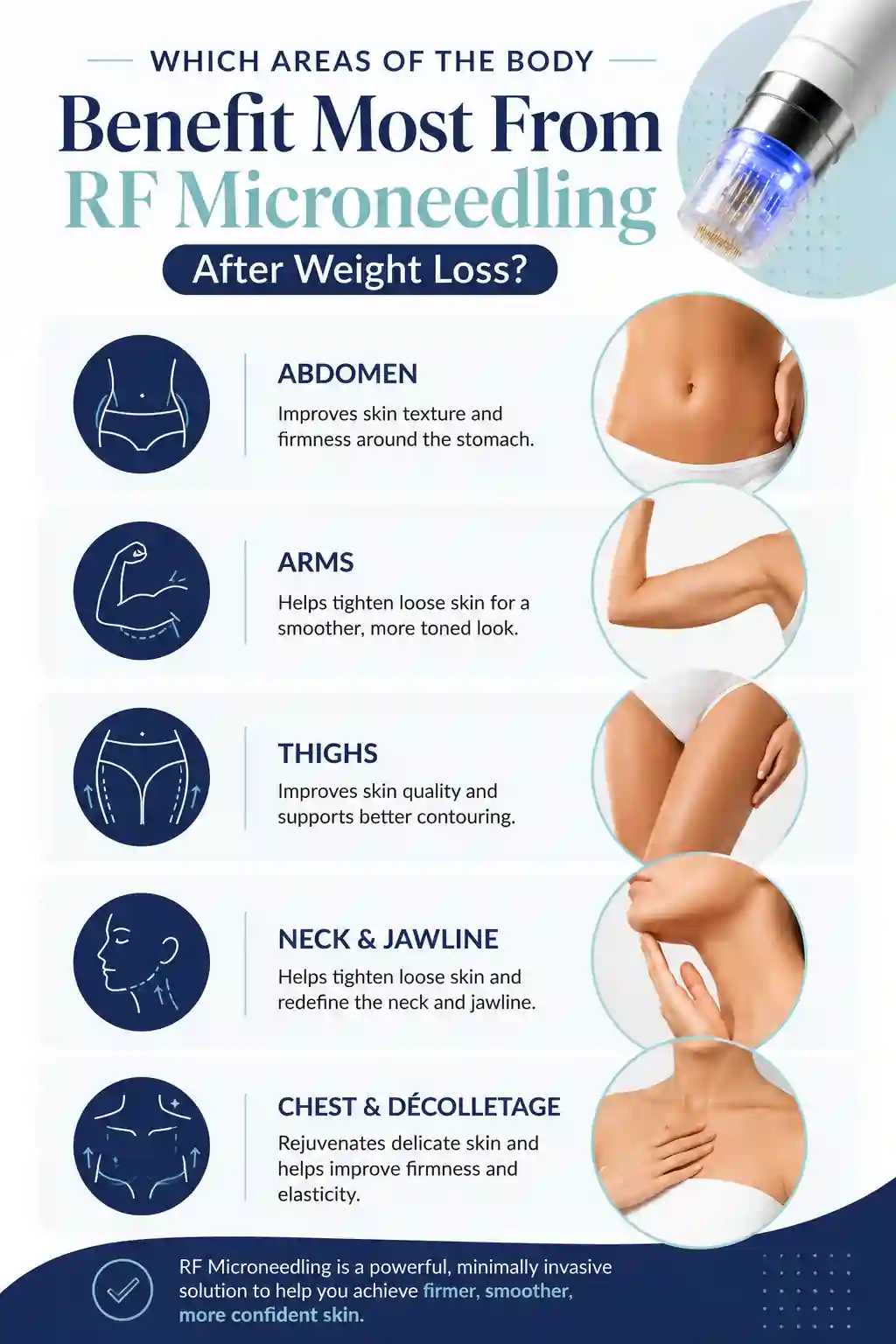 Which Areas of the Body Benefit Most From RF Microneedling After Weight Loss Uppingham